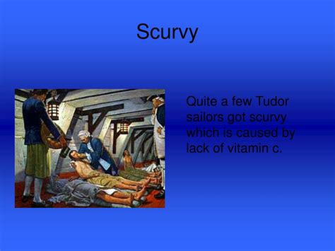 tudor sailor scurvy